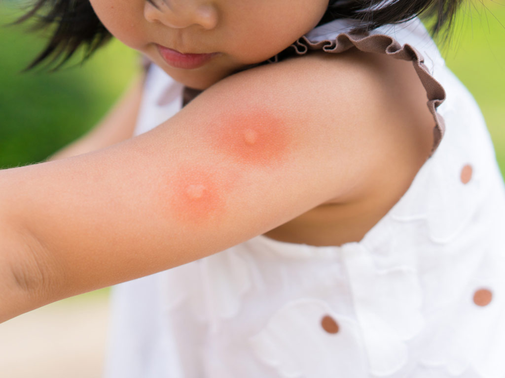 kako zastititi bebu od komaraca